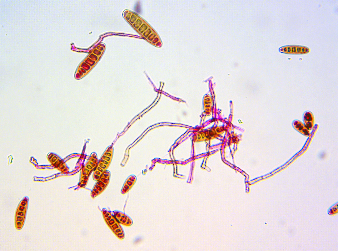 Bipolaris sorokiniana, the fungus causing spot blotch in wheat. (Photo: Xinyao He and Pawan Singh/CIMMYT)